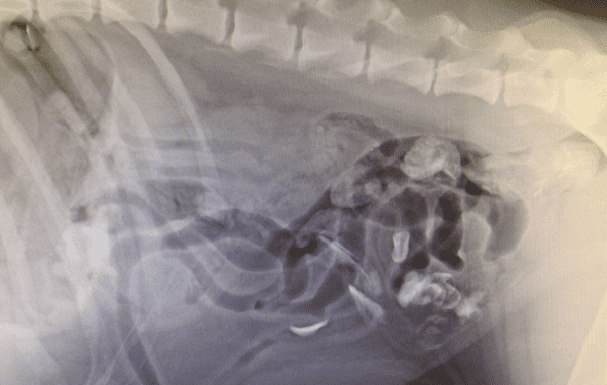 xray-of-abdomen-showing-bony-fragments-inside-intestine